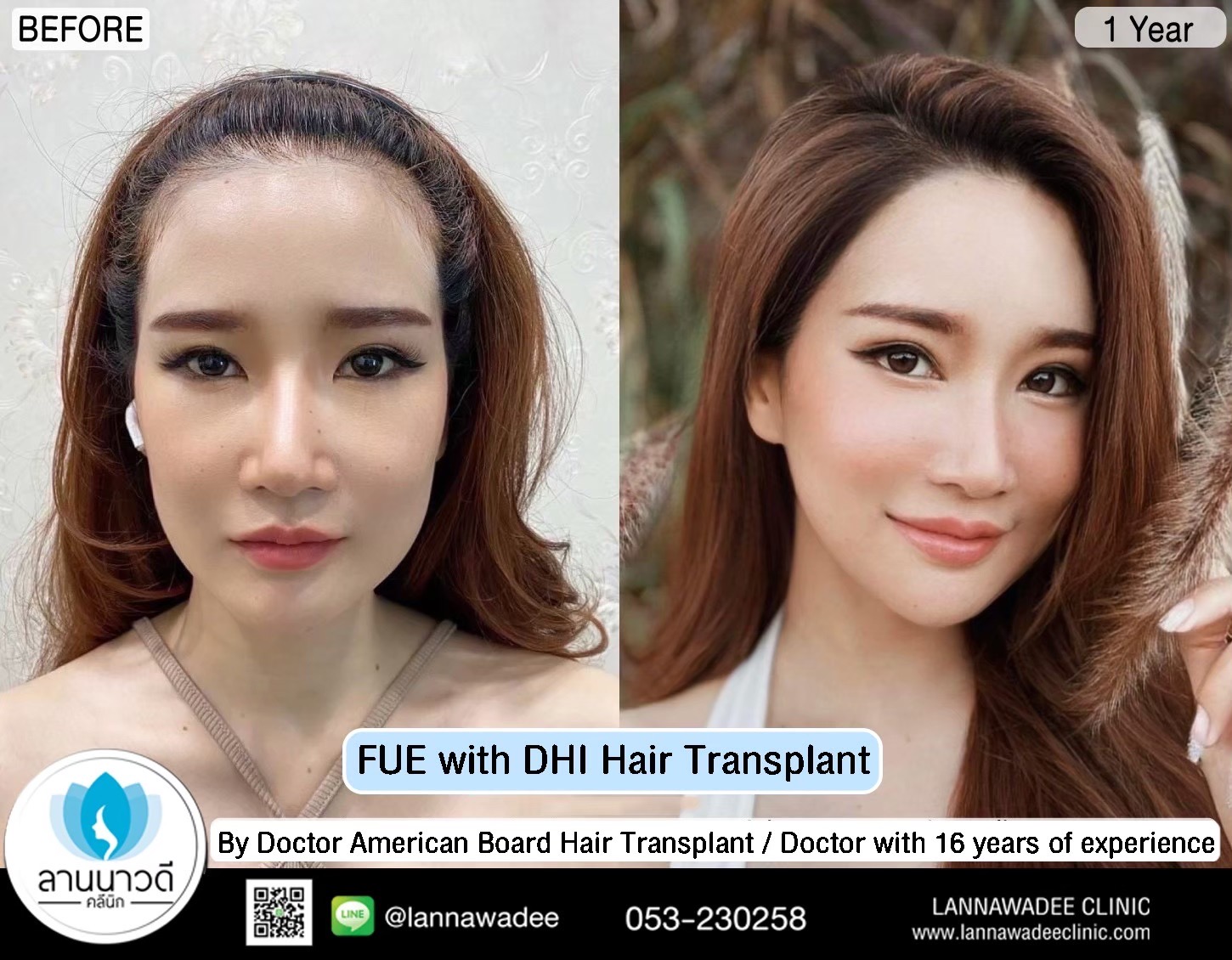 Cosmetic surgery clinic chiang mai