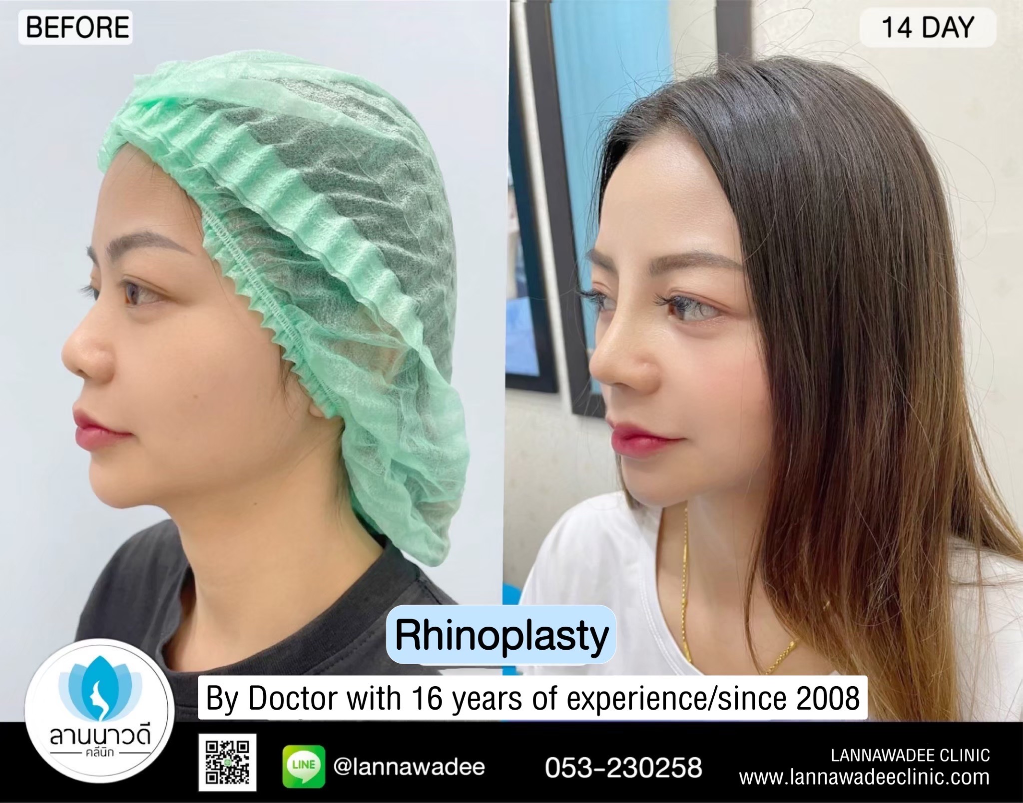 Cosmetic surgery clinic chiang mai