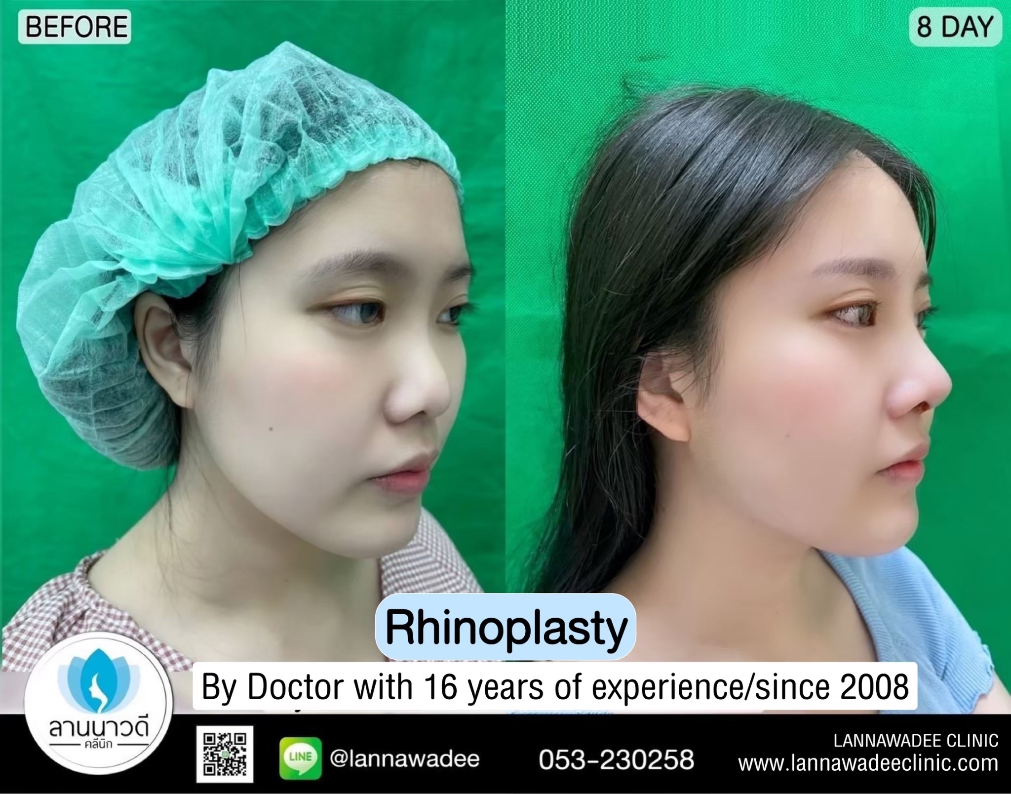 Cosmetic surgery clinic chiang mai