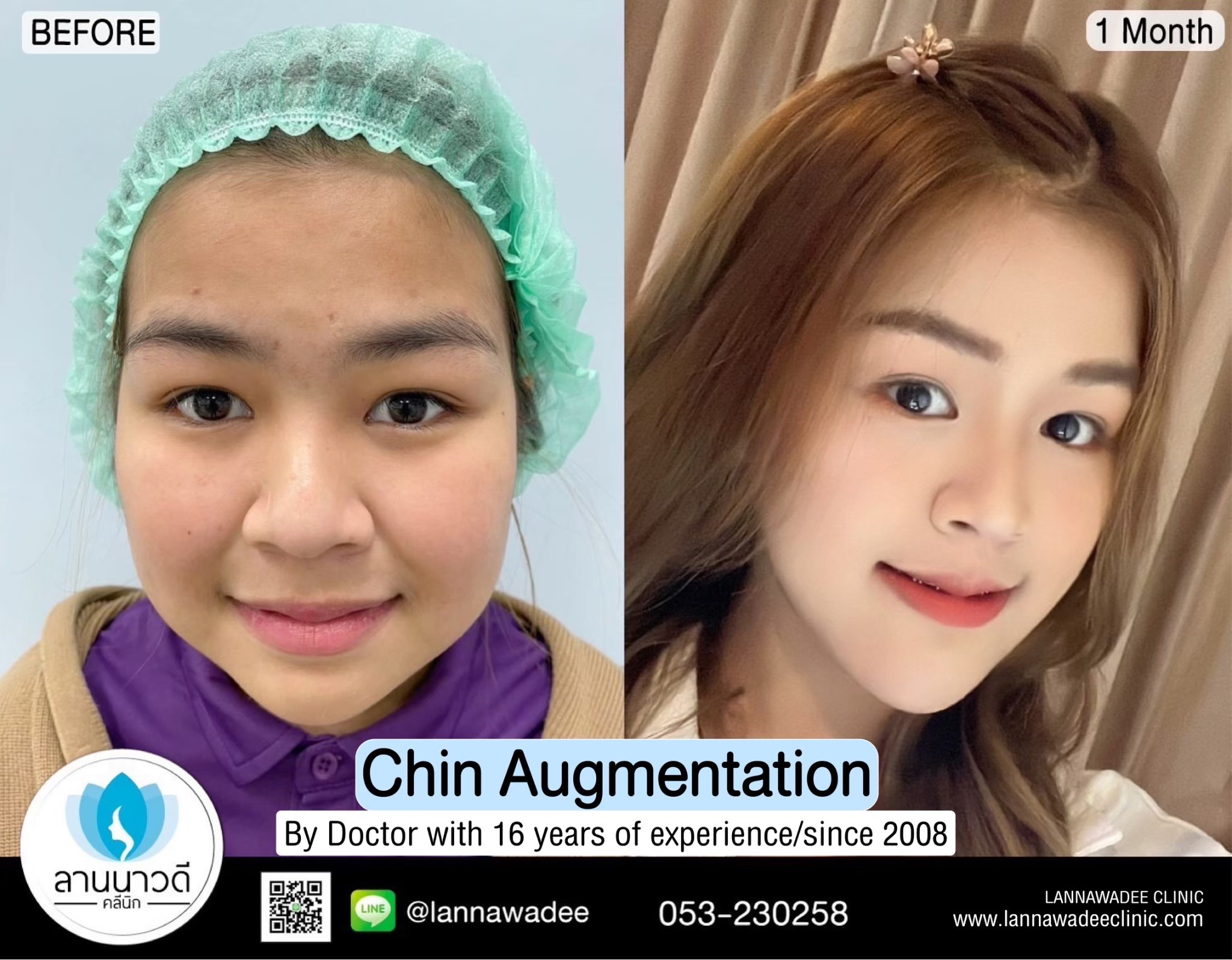 Cosmetic surgery clinic chiang mai