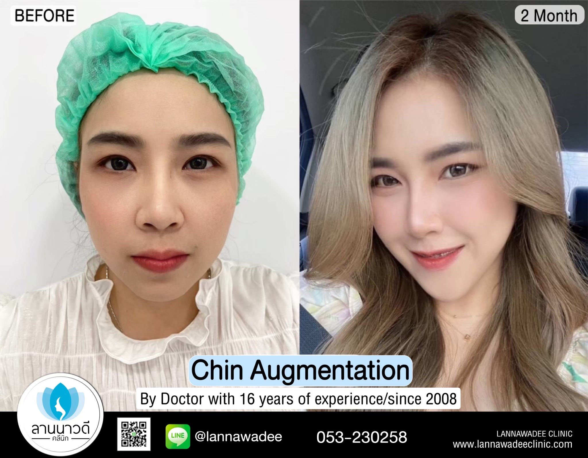 Beauty clinic chiang mai