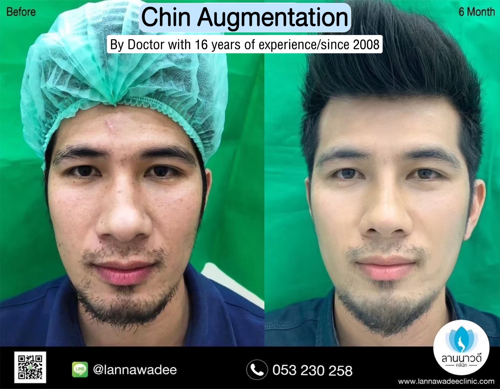 Cosmetic surgery clinic chiang mai