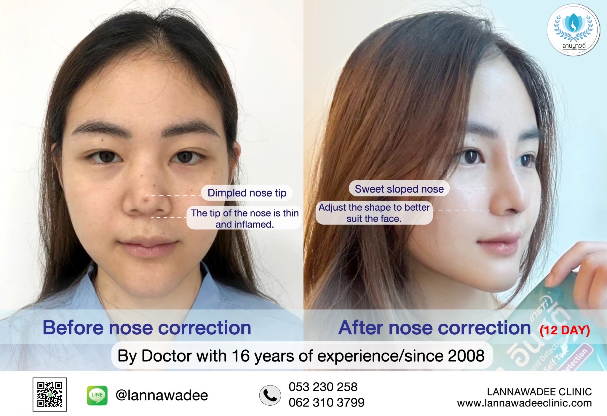 Cosmetic surgery clinic chiang mai