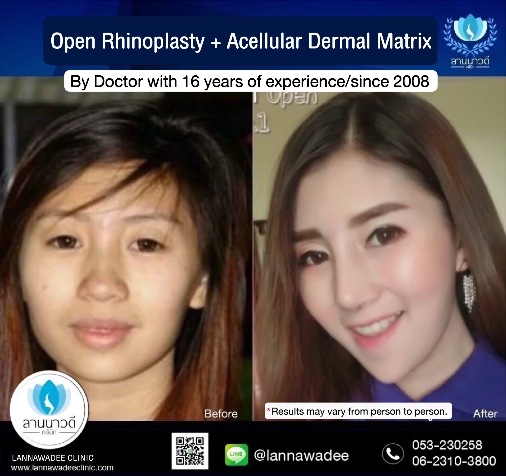 Beauty clinic chiang mai