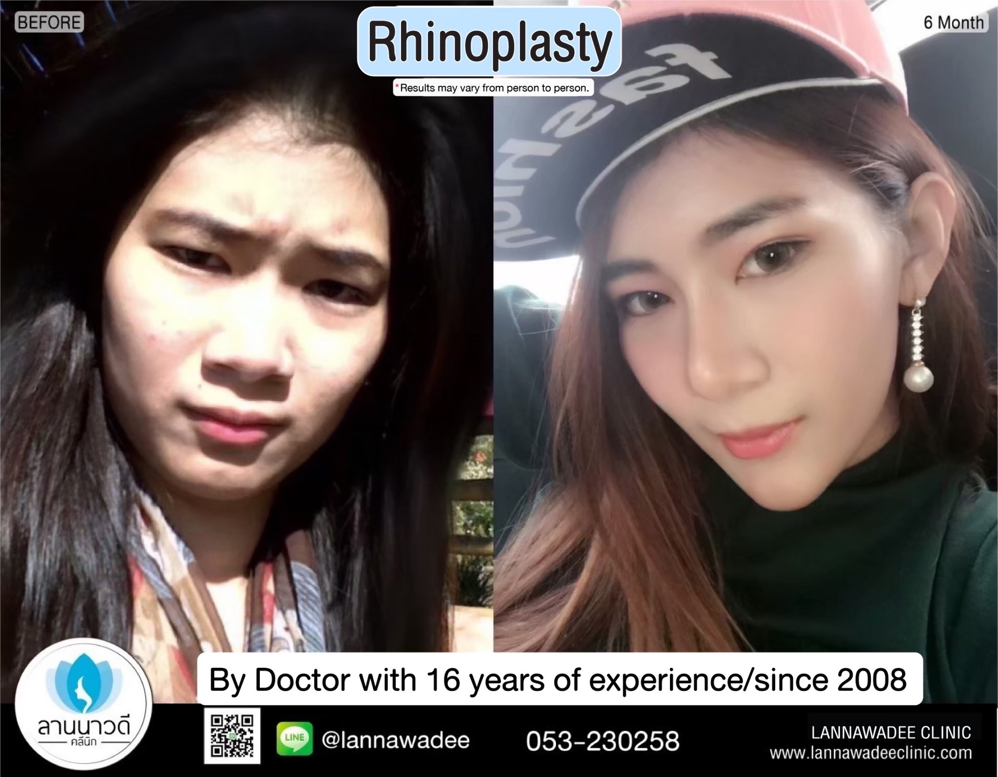 Cosmetic surgery clinic chiang mai