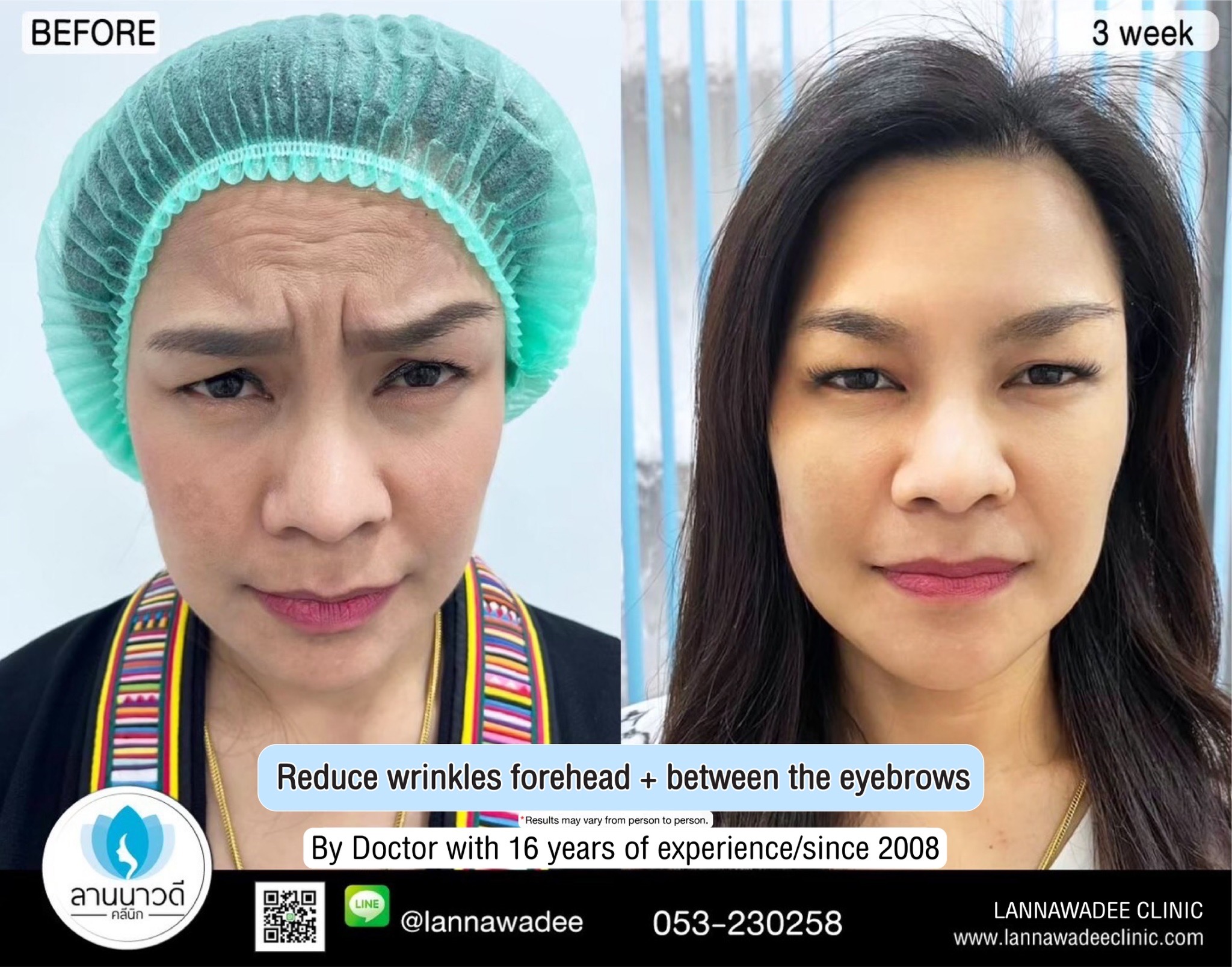 Cosmetic surgery clinic chiang mai